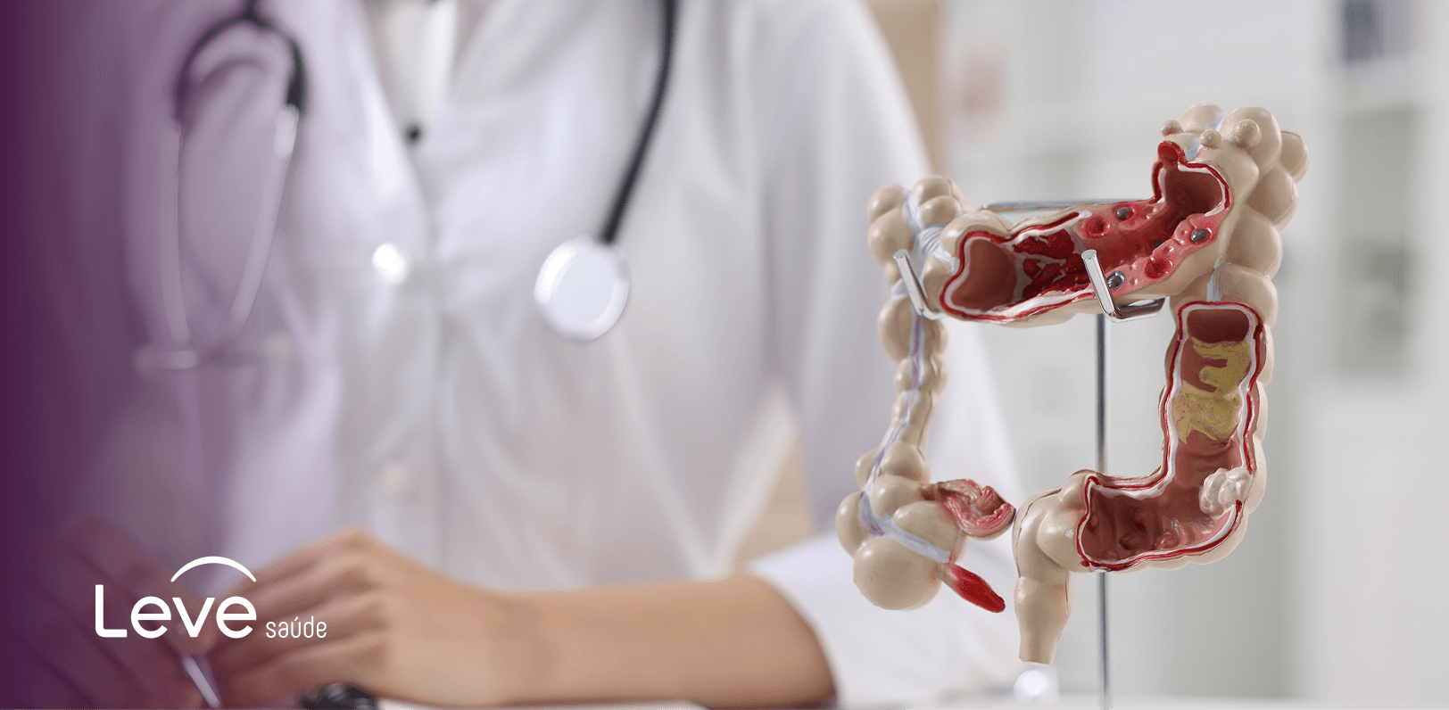 Colonoscopia: o que é, como é feito, e por que é importante para a prevenção do câncer